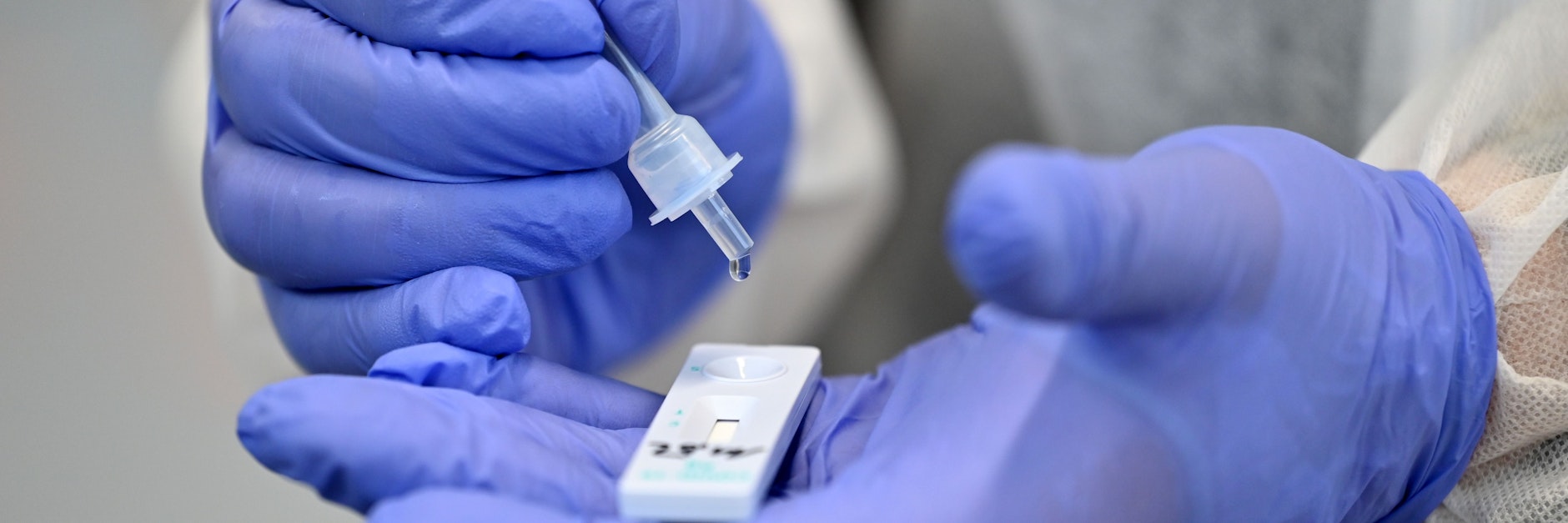 Corona-Schnelltests sind nicht immer zuverlässig.