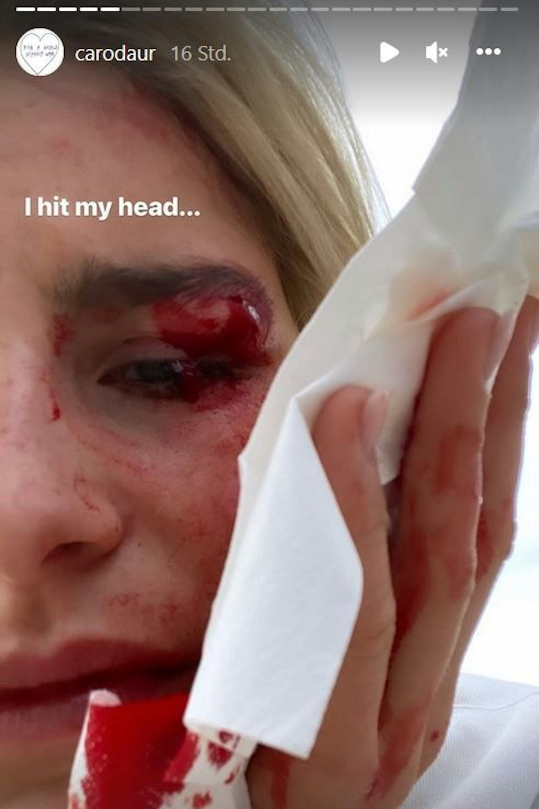 Caro Daur mit blutender Wunde. 