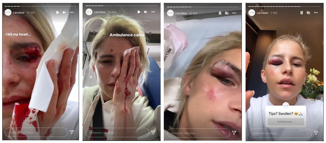 Image - Erschreckende Bilder: Caro Daur blutend ins Krankenhaus eingeliefert – was ist da passiert?