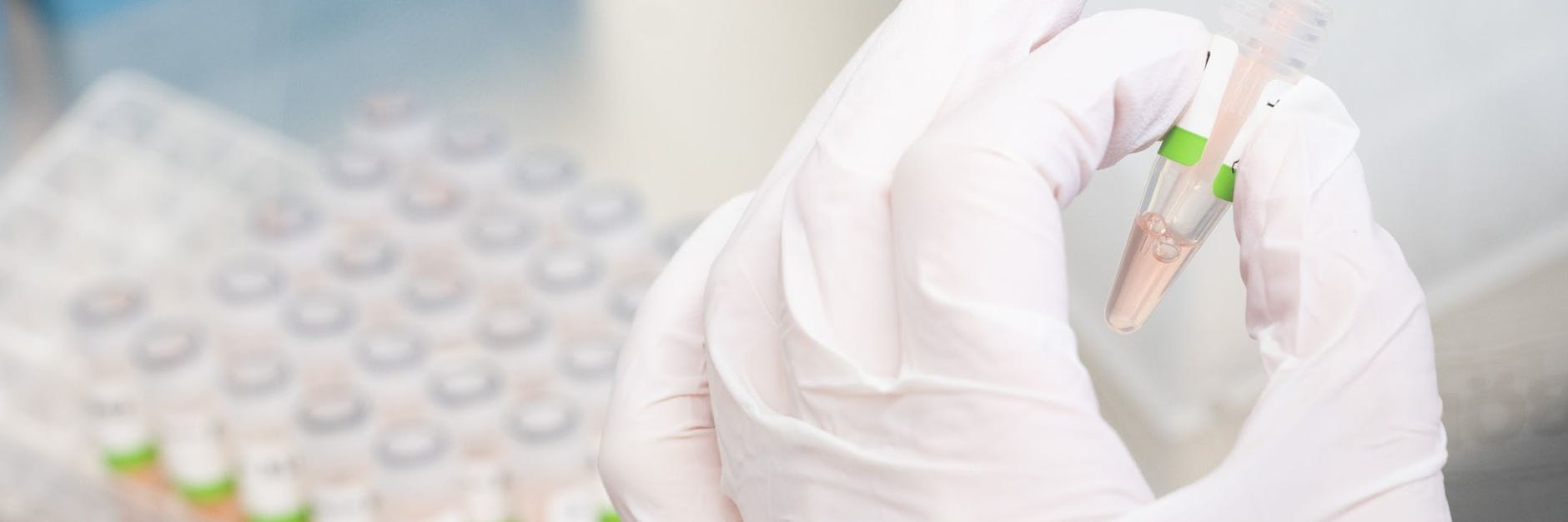 Eine biologisch-technische Assistentin bereitet PCR-Tests auf das Coronavirus vor.