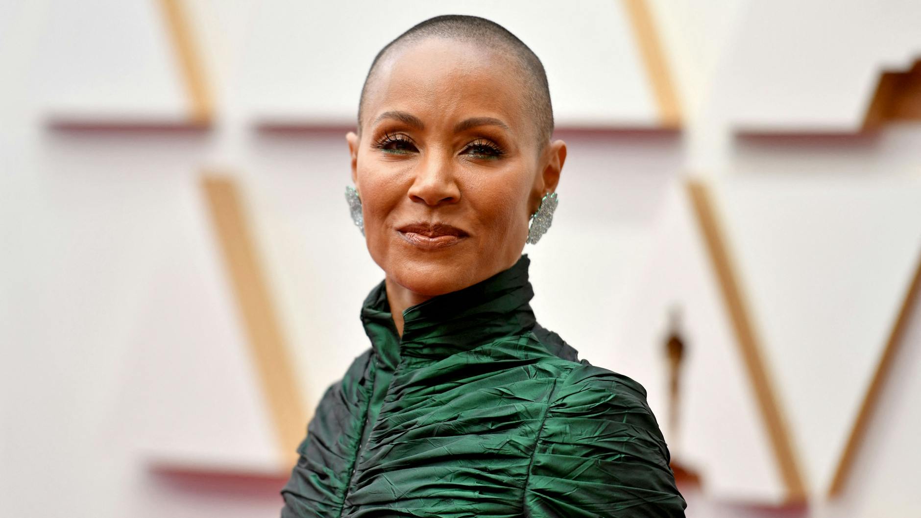 Die Schauspielerin Jada Pinkett Smith sprach erstmals im Jahr 2018 öffentlich über ihre Diagnose Alopecia areata.