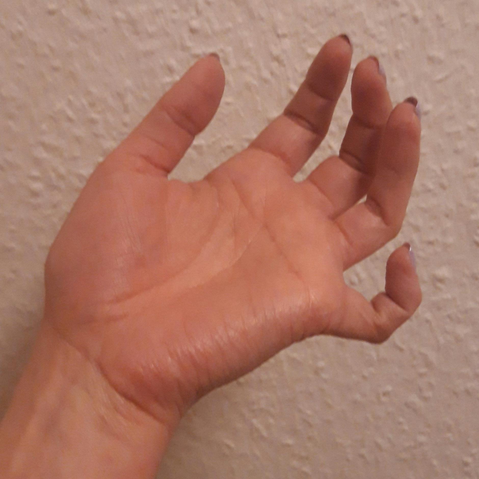 ... jetzt hat sie eine Krallenhand.