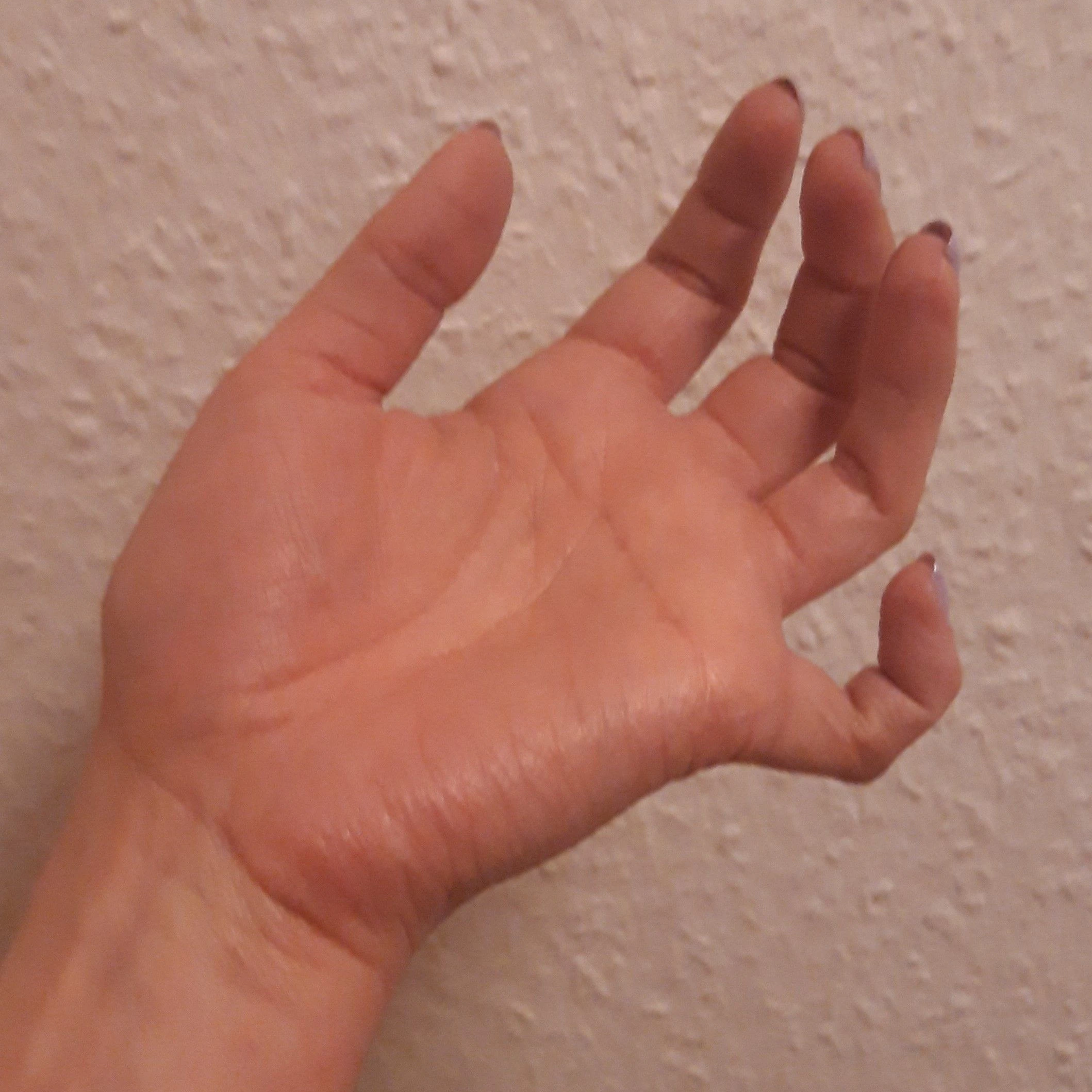 ... jetzt hat sie eine Krallenhand.