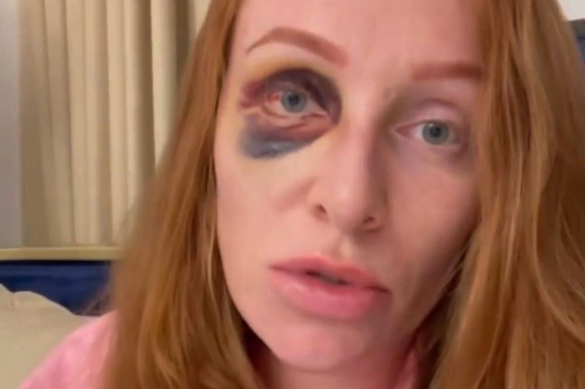 Vor fünf Tagen soll ihr Ex Kubilay Özdemir  Georgina Fleur ins Gesicht geschlagen haben.