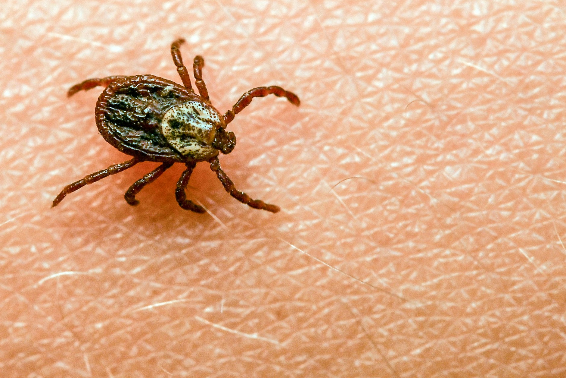 Zecken können diverse Krankheiten übertragen. Unfallversicherte sollten daher ihre Police prüfen.
