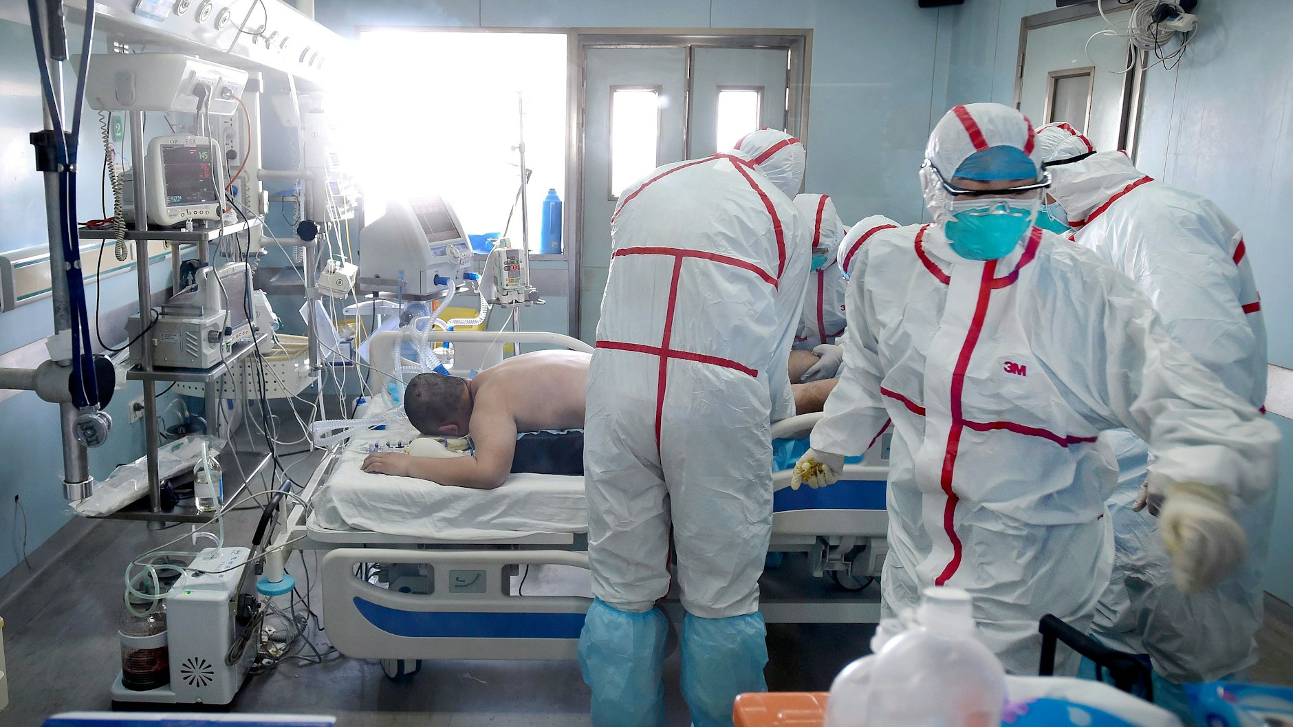 Patient in der chinesischen Provinz Hubai: Er hatte sich mit einem anderen Virustyp der Vogelgrippe angesteckt.