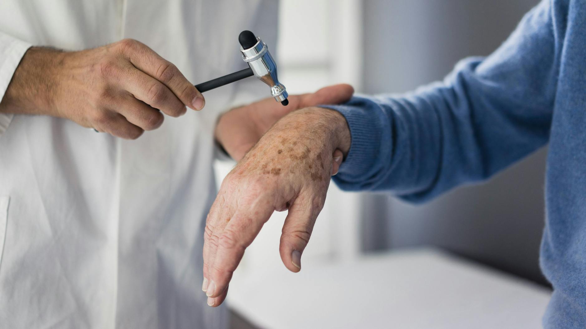 Altersflecken sind kein Grund zur Sorge, sollten aber dennoch ärztlich begutachtet werden.