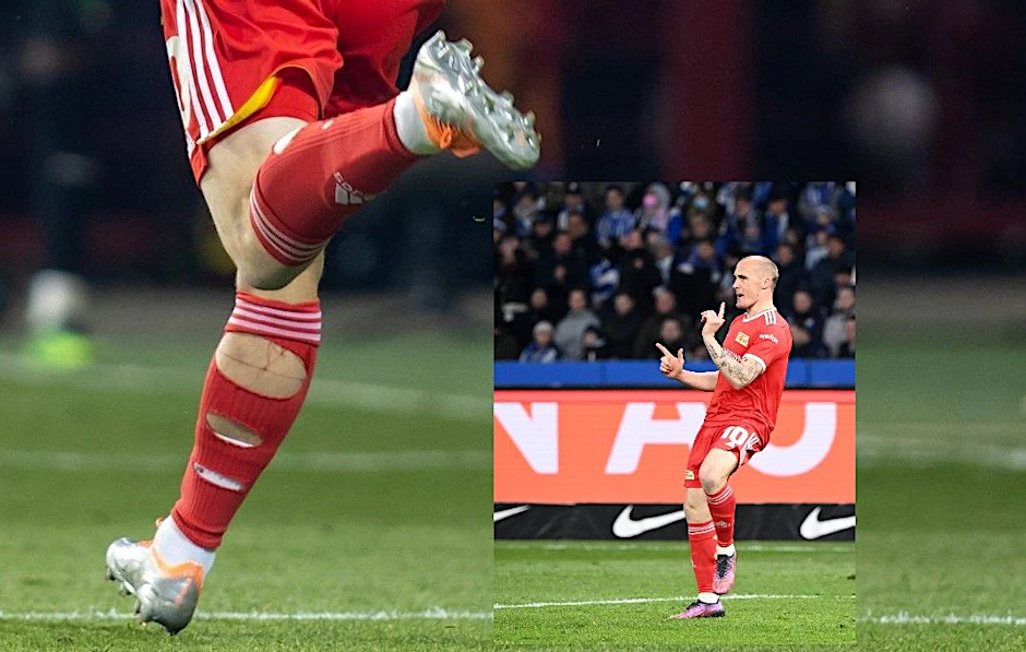 Drei Löcher in den Stutzen! Sven Michel vom 1. FC Union verriet jetzt, was es damit auf sich hat.