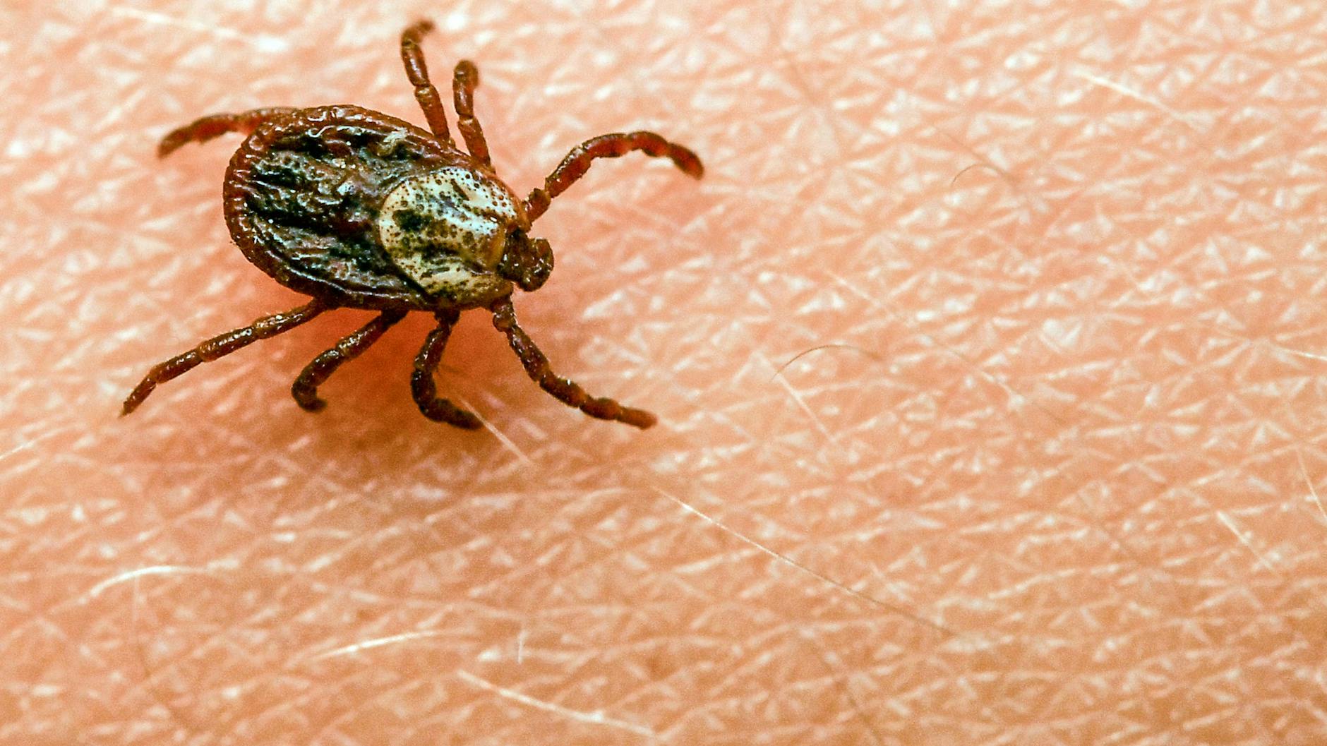 Zeckenbisse können gefährlich werden.