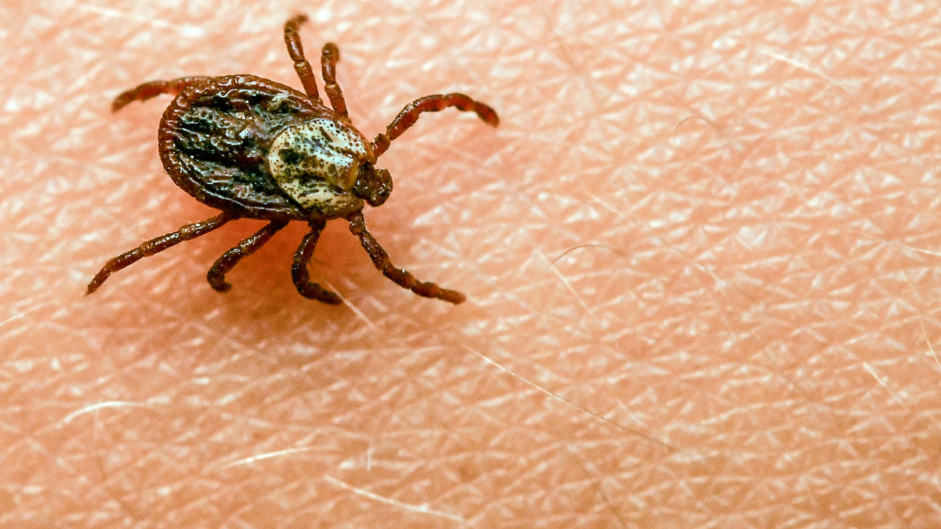 Zeckenbisse können gefährlich werden.