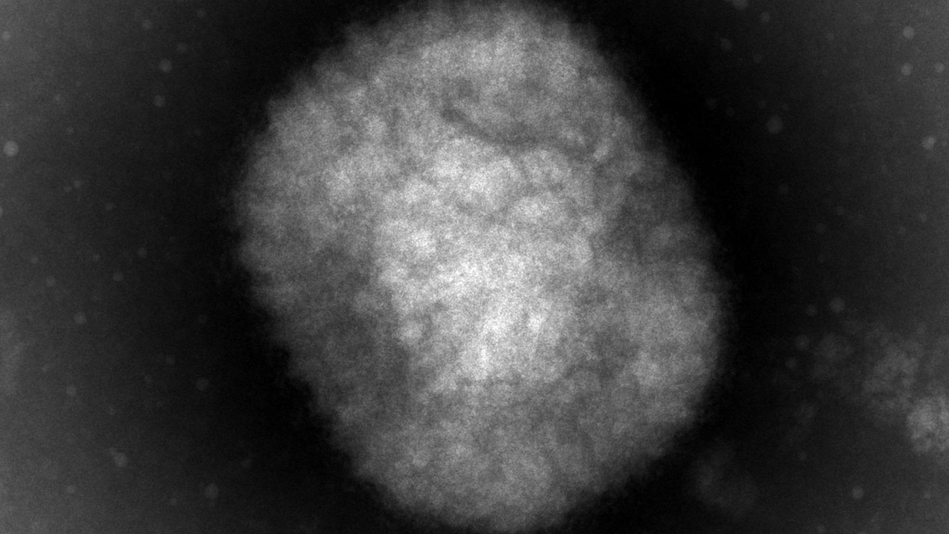 Affenpocken unter dem Elektronenmikroskop.