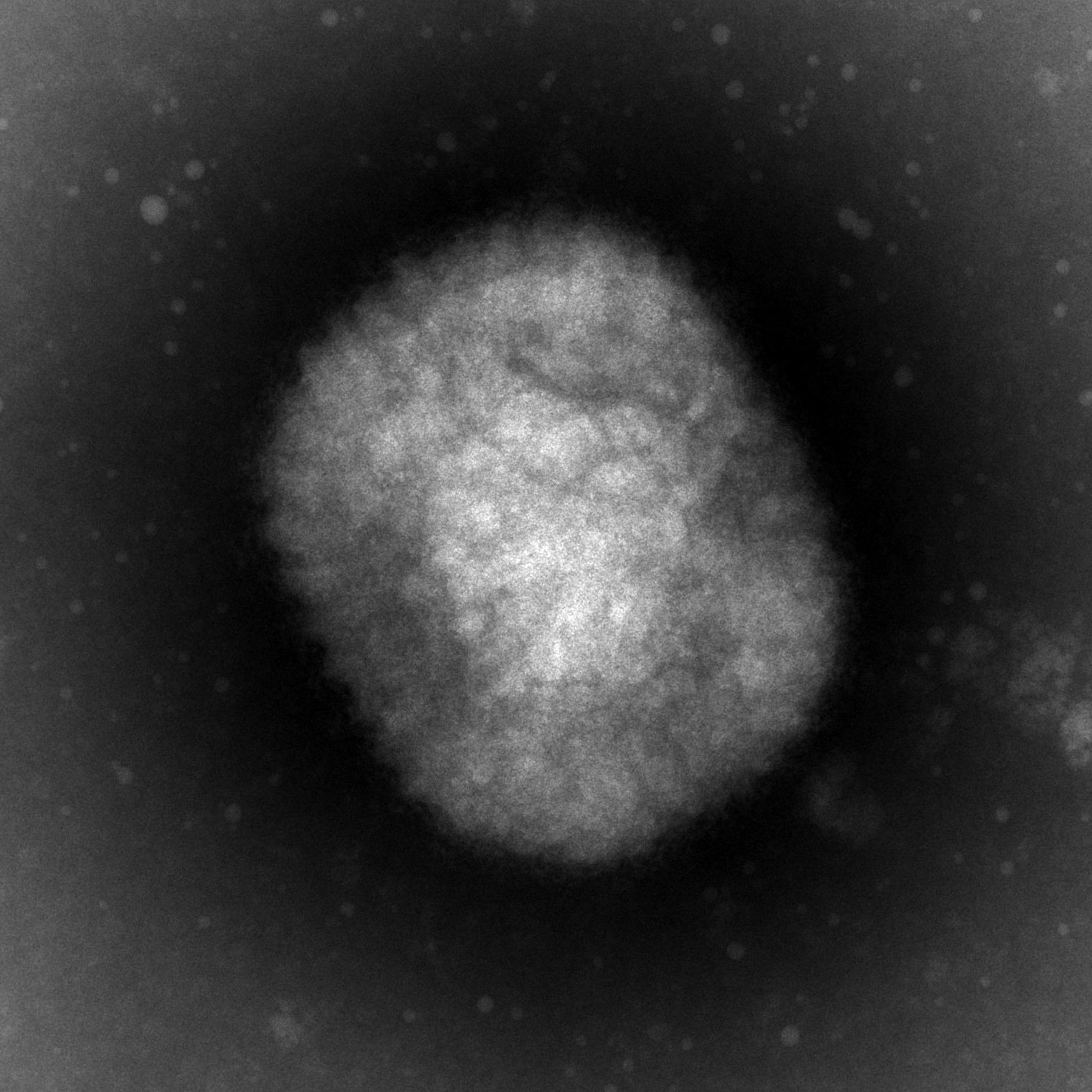 Neue Fälle: Affenpocken breiten sich weiter in Berlin aus