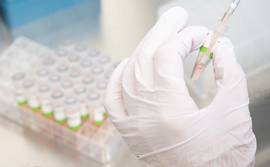 Auch die Affenpocken werden mit einem PCR-Test nachgewiesen. 