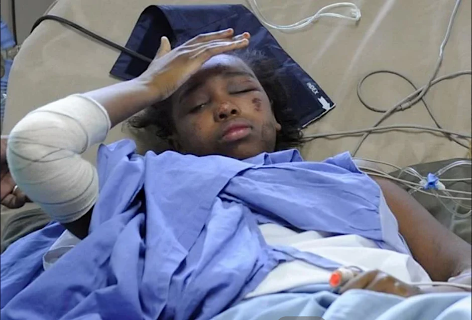 Die damals zwölfjährige Bahia kirz nach dem Absturz im Krankenhaus.
