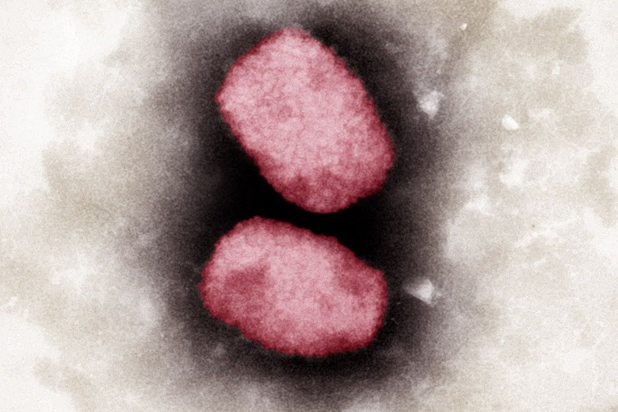 Elektronenmikroskopische Aufnahme von Affenpocken-Viren, koloriert für bessere Bildqualität. Affenpocken werden durch engen Körperkontakt von Mensch zu Mensch übertragen.