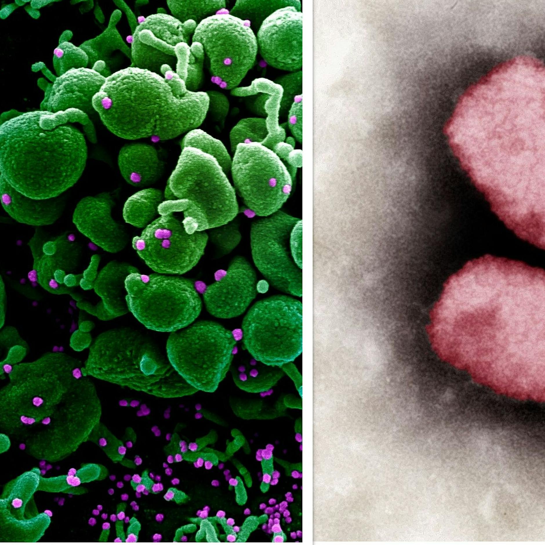 So unterscheidet sich Corona von Affenpocken – und das haben die beiden Erreger gemeinsam!