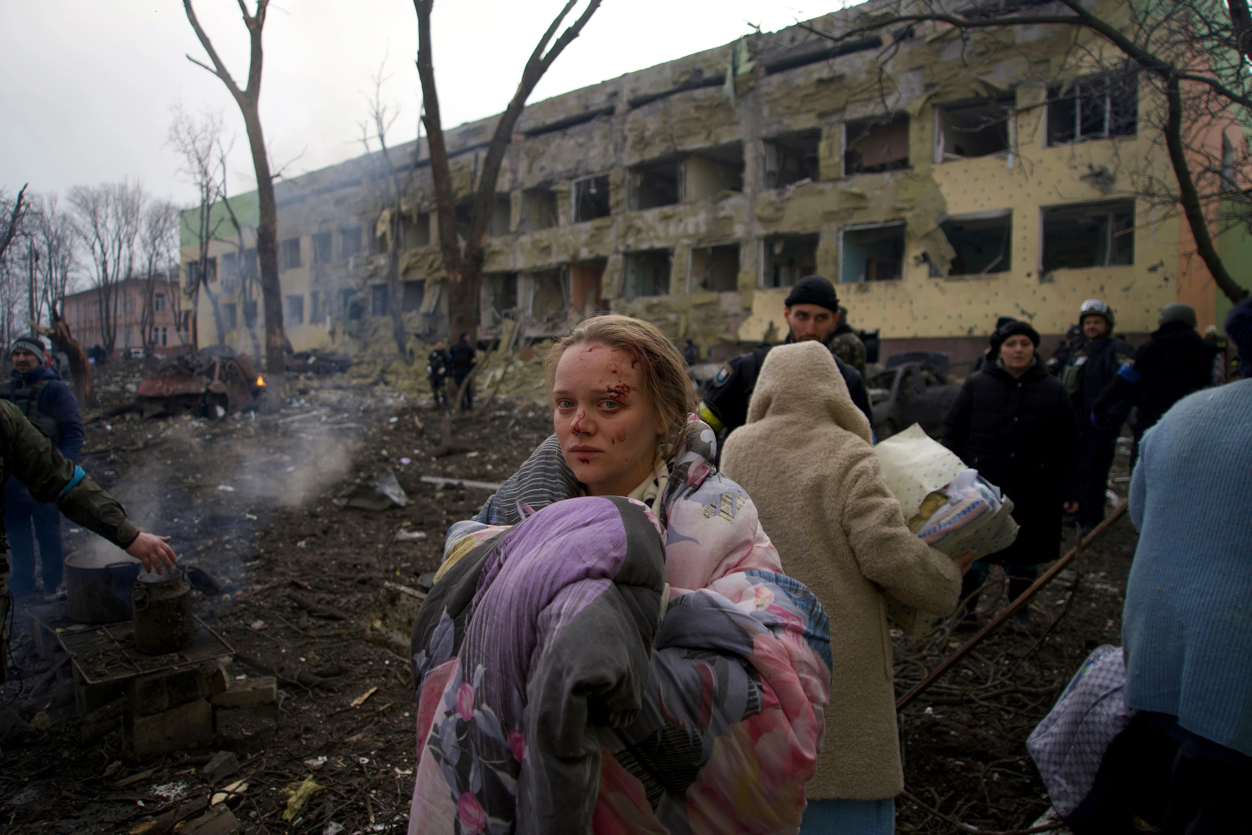 Mariana Vishegirskaya steht vor einem durch Beschuss beschädigten Entbindungskrankenhaus. Vishegirskaya überlebte den Beschuss und brachte später in einem anderen Krankenhaus in Mariupol ein Mädchen zur Welt. Die Bilder von der zerstörten Klinik gingen um die Welt.
