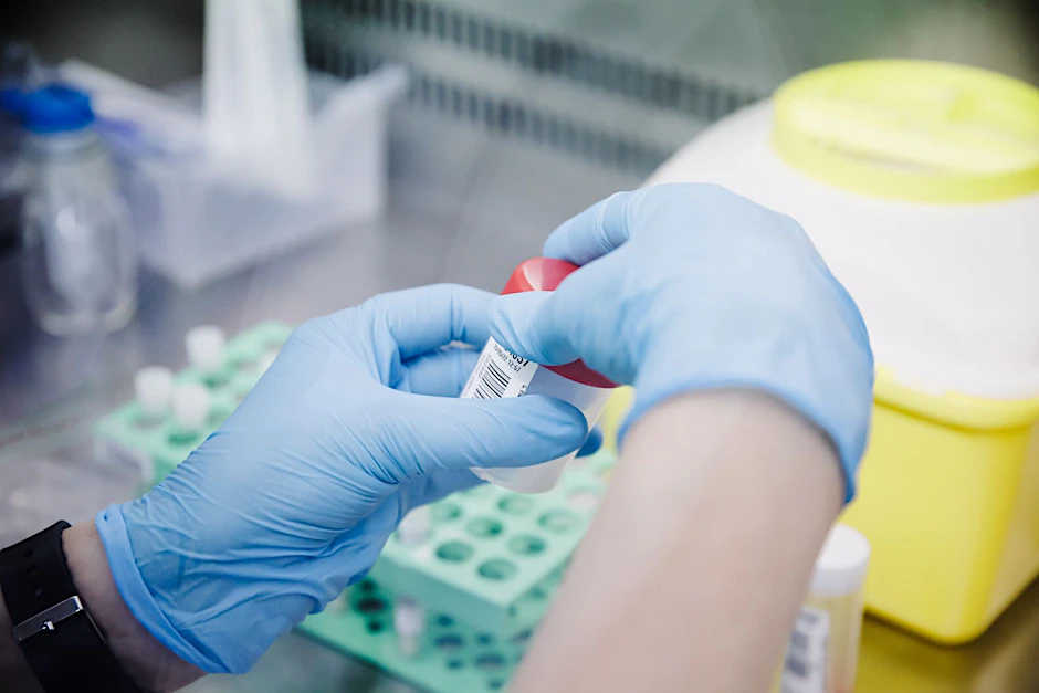 Eine Laborkraft bereitet einen PCR-Test vor, um einen Abstrich auf Affenpockenviren zu untersuchen. (Symbolbild)