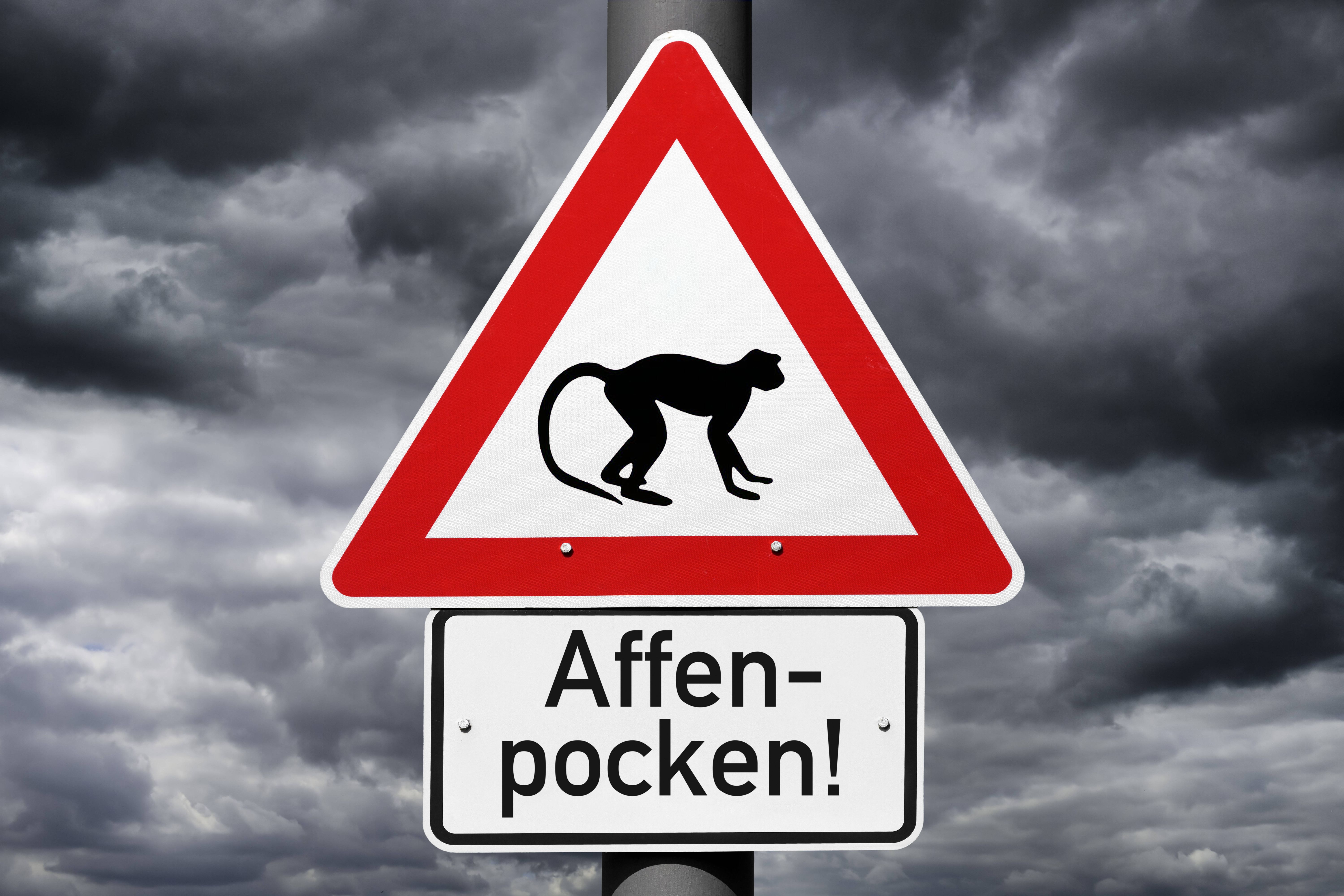 Image - Infektions-Schreck: Affenpocken-Zahlen haben sich in wenigen Tagen in Berlin verdoppelt!