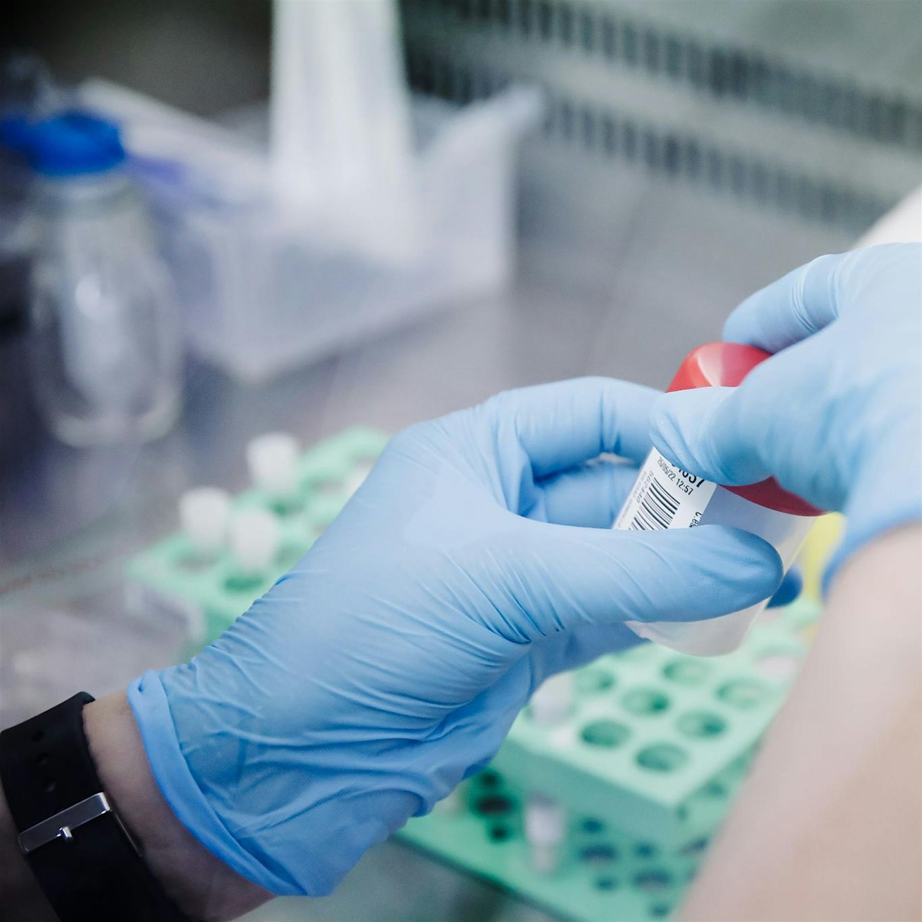 WHO vermutet Umweltfaktoren hinter Affenpocken