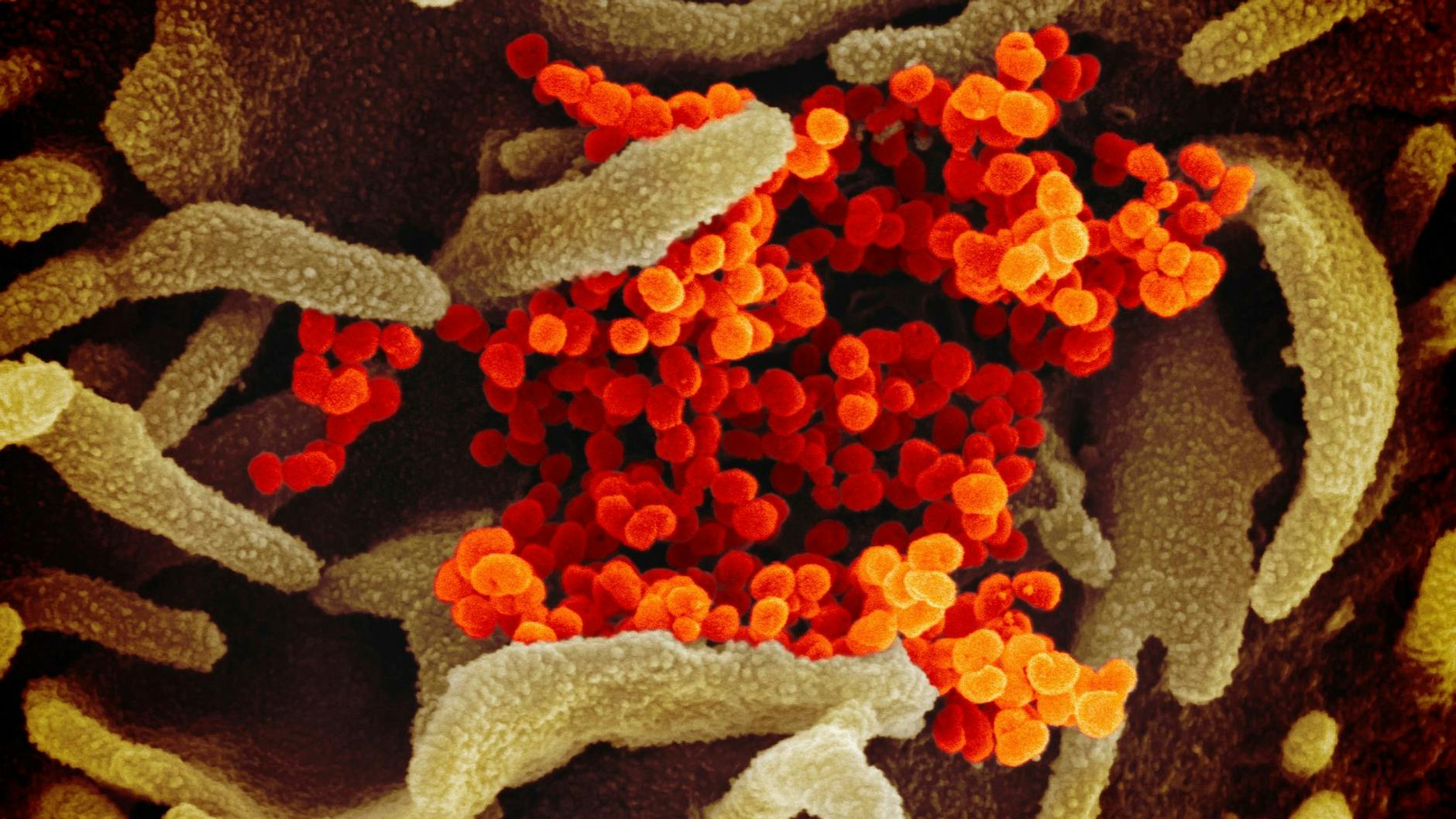 Das Coronavirus (orange), das aus der Oberfläche von im Labor kultivierten Zellen (grau) austritt.
