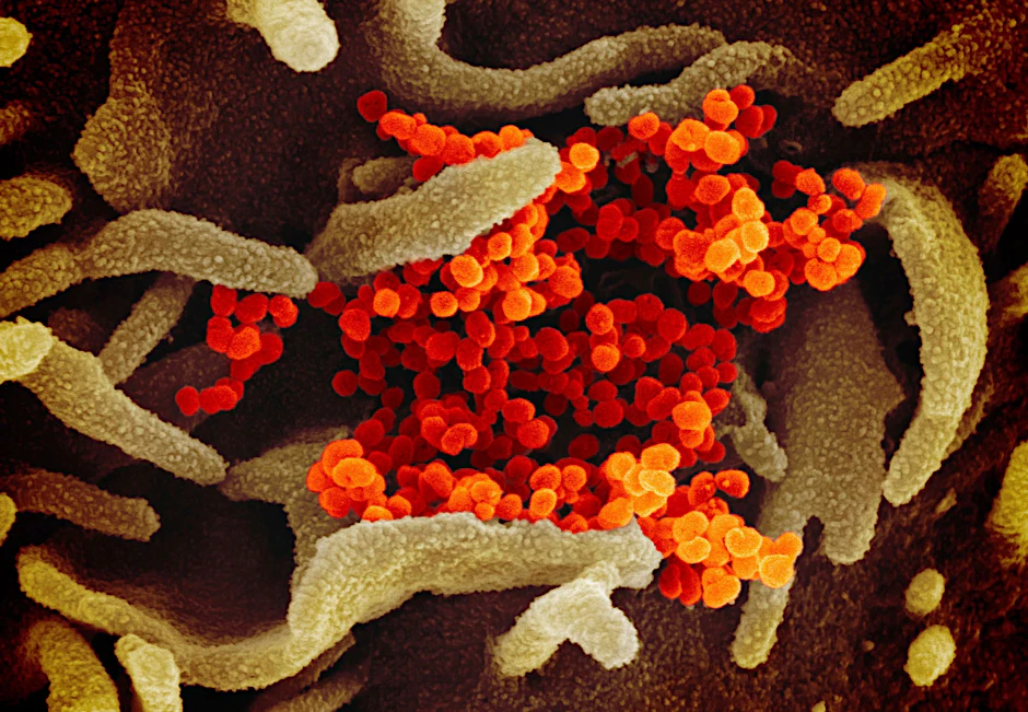 Das Coronavirus (orange), das aus der Oberfläche von im Labor kultivierten Zellen (grau) austritt.