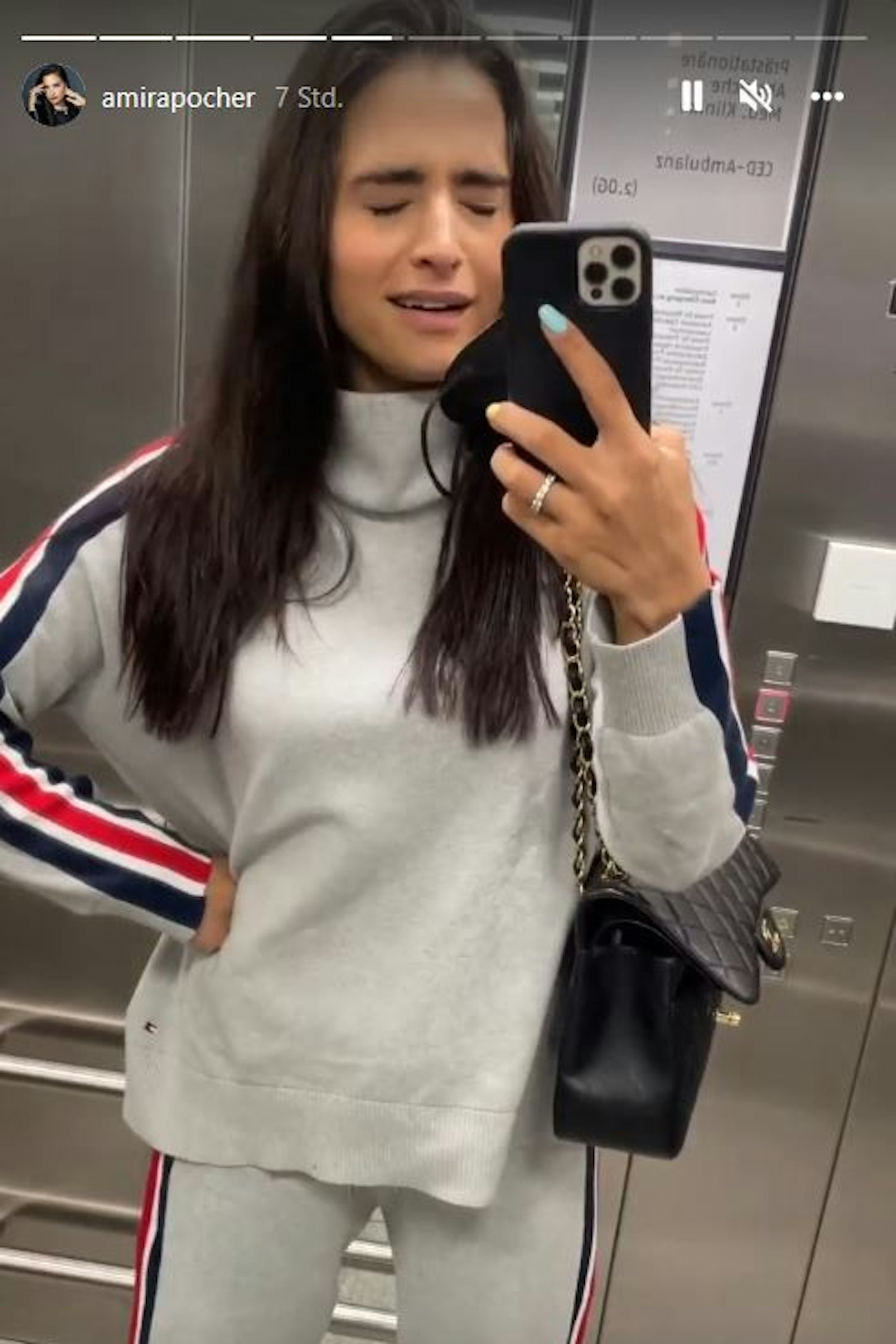 Aua... Amira Pocher hat Angst vor den Schmerzen beim Lasern.