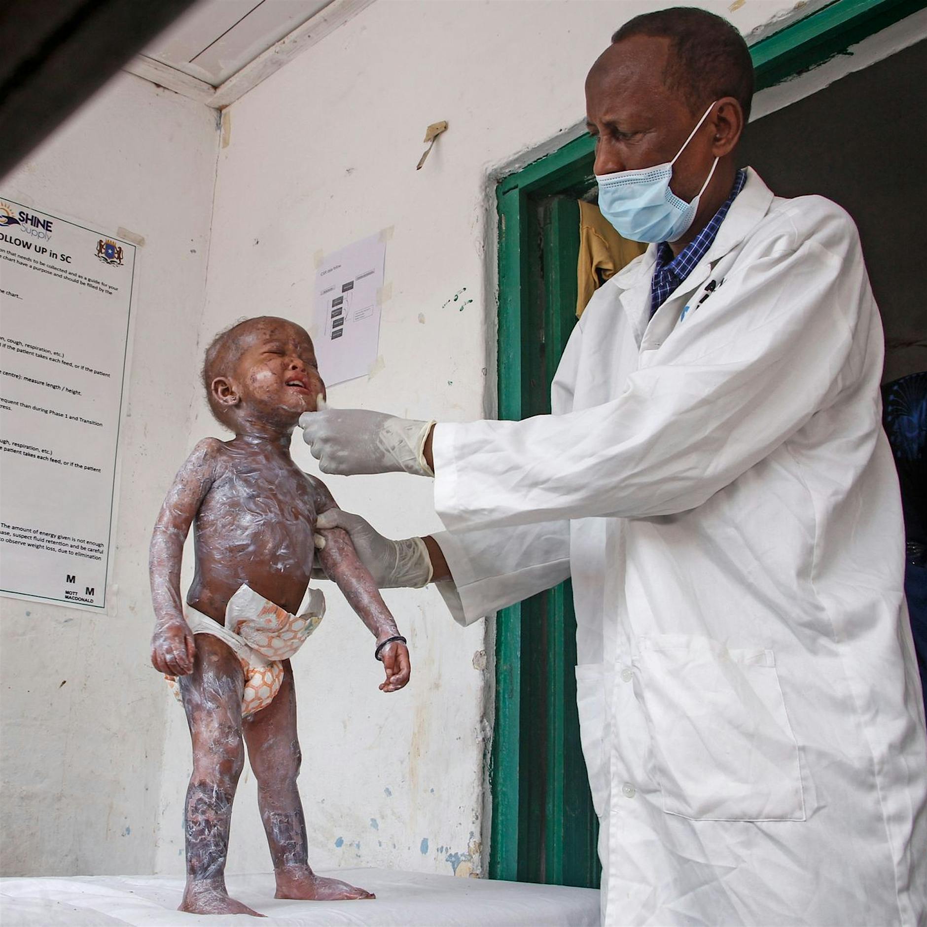 Millionen Menschen von Dürre und Hunger betroffen