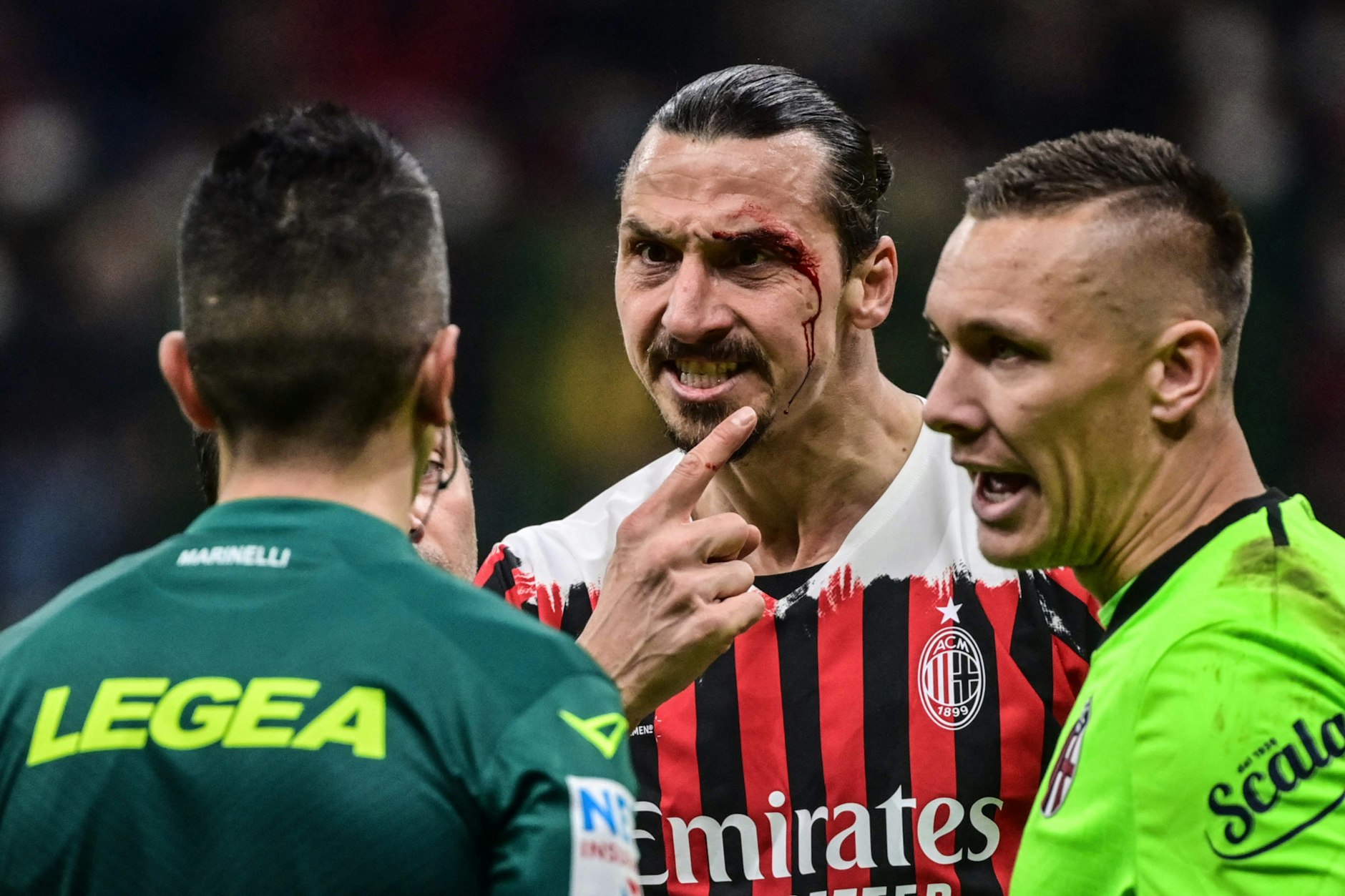 Ein Zlatan Ibrahimovic kennt keinen Schmerz? Trotz Kopfverletzung spielte der 40-jährige Fußballprofi vom AC Mailand im April im Spiel gegen Bologna weiter.