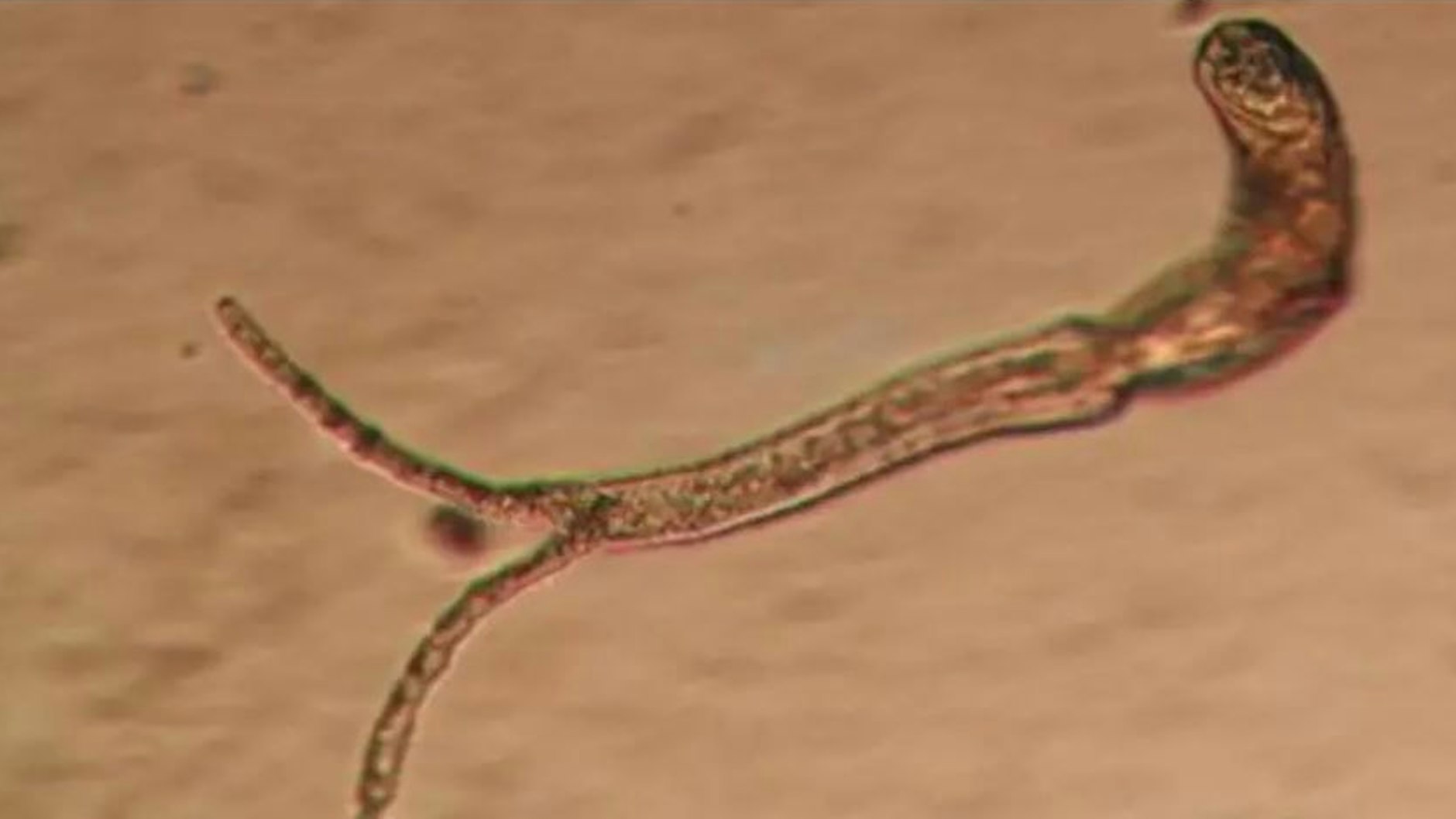 So sehen diese Zerkarien unter dem Mikroskop aus.