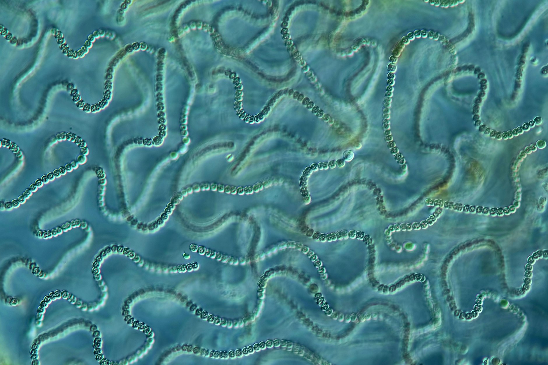 Blaualgen unter einem Mikroskop