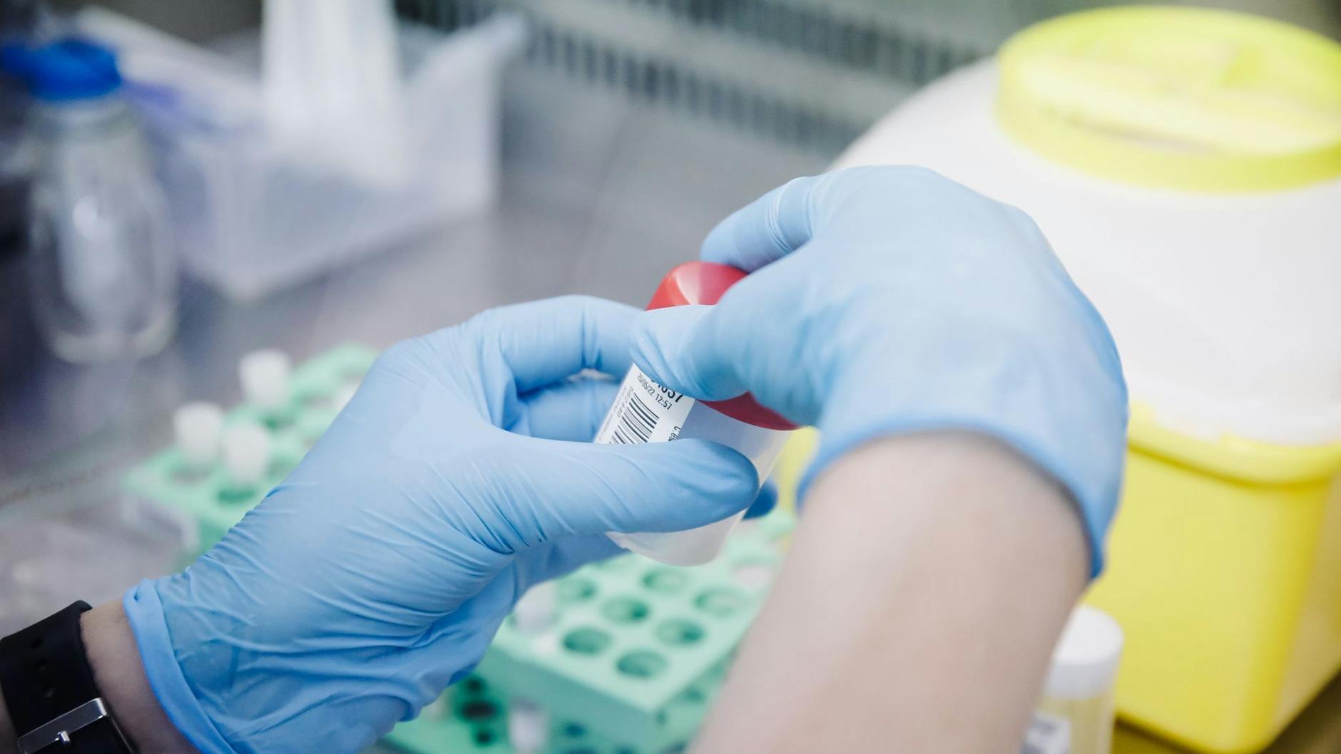 Eine Krankenschwester führt einen PCR-Test zur Erkennung des Affenpockenvirus durch. (Symbolbild)