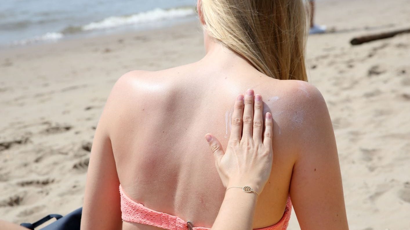 Sonnencreme verringert das Risiko von Hauterkrankungen. (Symbolbild)