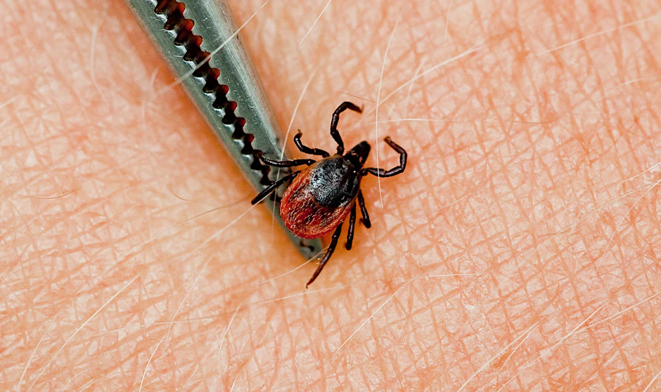 Ob Zange, Karte oder Haken: Es gibt allerlei Werkzeug, um Zecken zu entfernen.