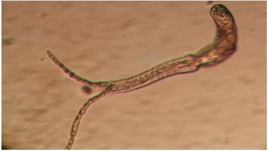 Saugwurm-Zerkarien können Hautrötungen, Quaddeln und Juckreiz verursachen.