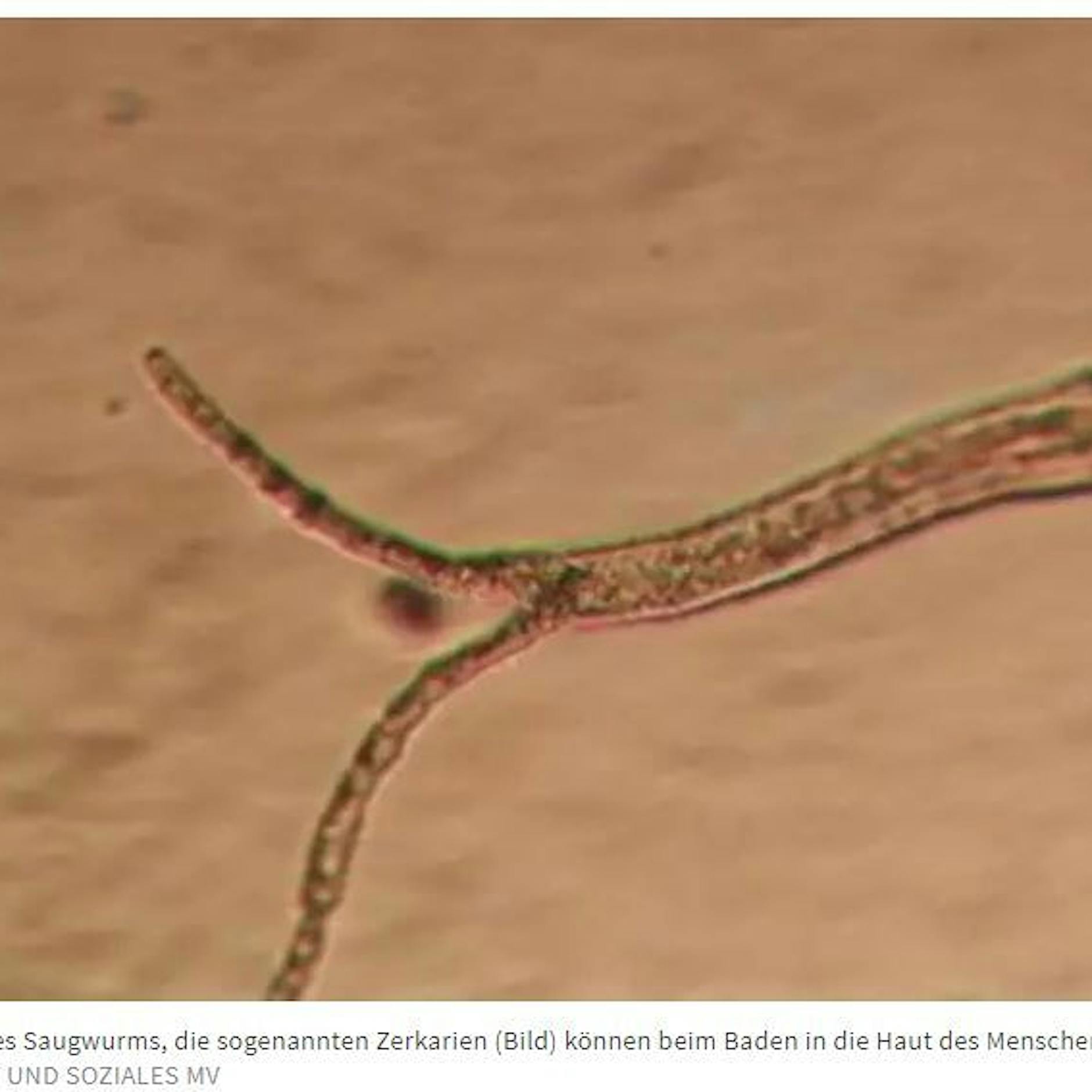 Saugwürmer, Blaualgen: Wie schütze ich mich beim Baden am See?