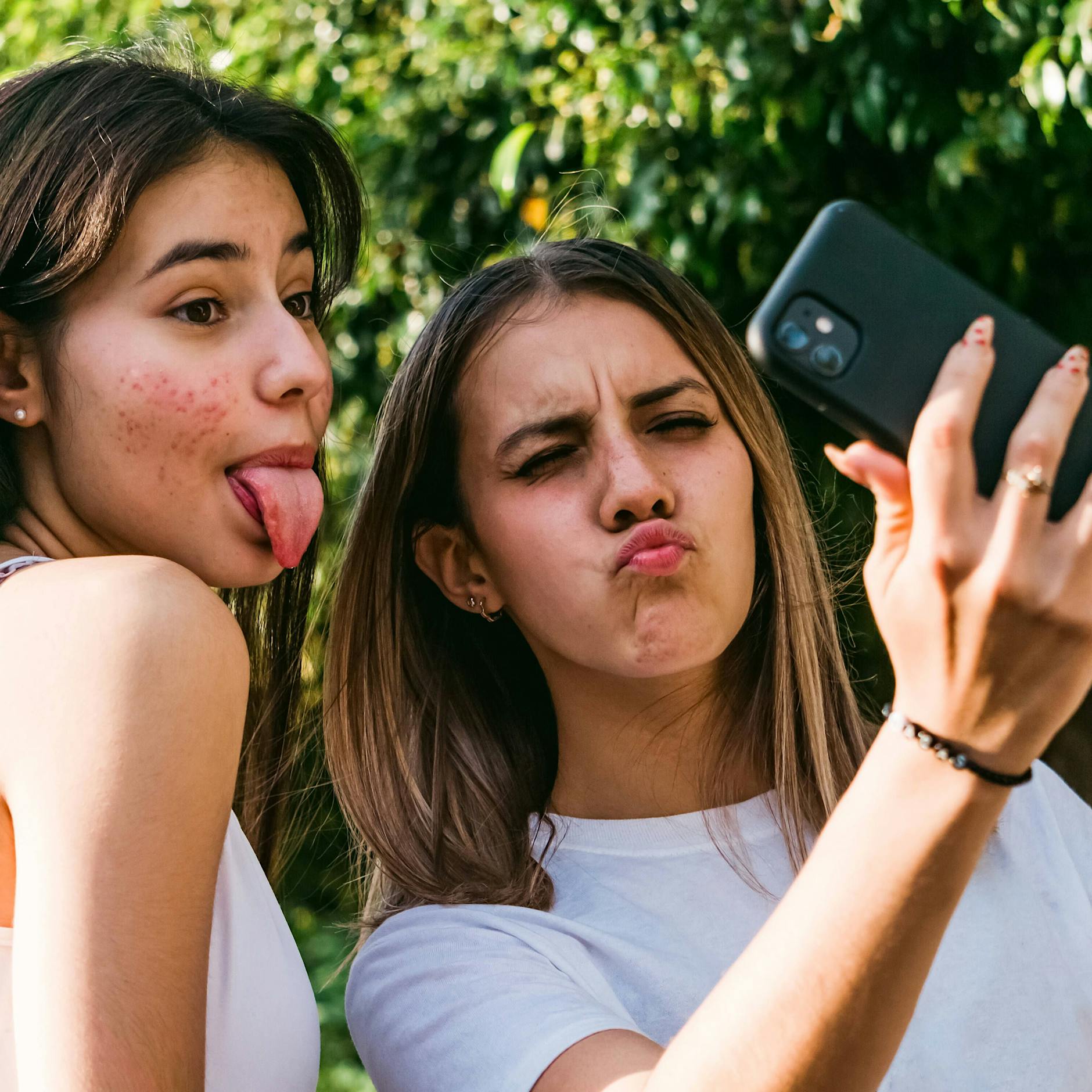 Erste Hilfe bei Akne: Was man essen sollte und was nicht, damit die nervigen Pickel wegbleiben