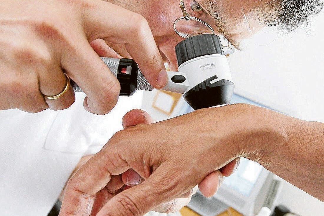 Hautärzte erkennen schnell, ob man Hautkrebs hat oder nicht.