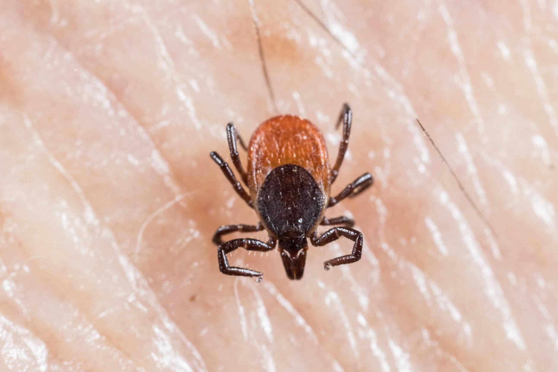 Eine Zecke sitzt auf menschlicher Haut.