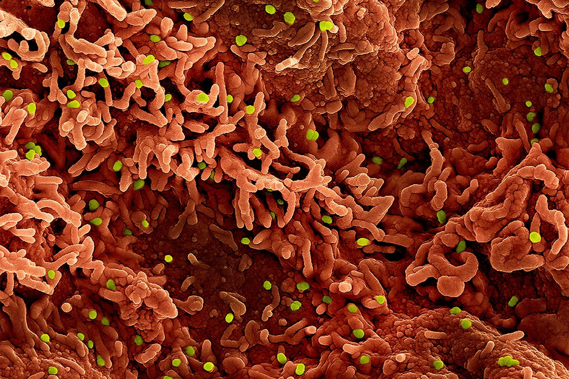 Eine kolorierte mikroskopische Aufnahme des Affenpockenvirus