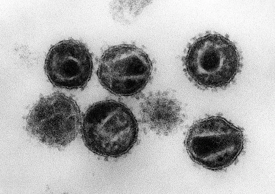 HANDOUT - Elektronenmikroskopische Aufnahme mehrerer HIV (Humane Immunschwäche-Viren) Erreger der Immunschwäche-Krankheit Aids.  itut/dpa