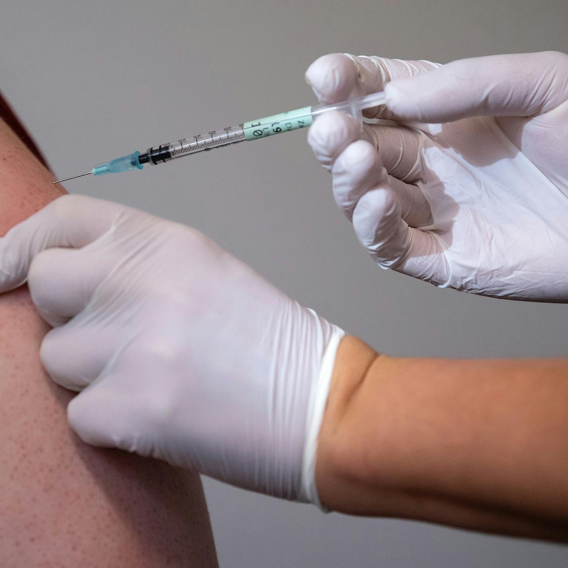 Affenpocken: Berlin bekommt 1900 Dosen zusätzlichen Impfstoff