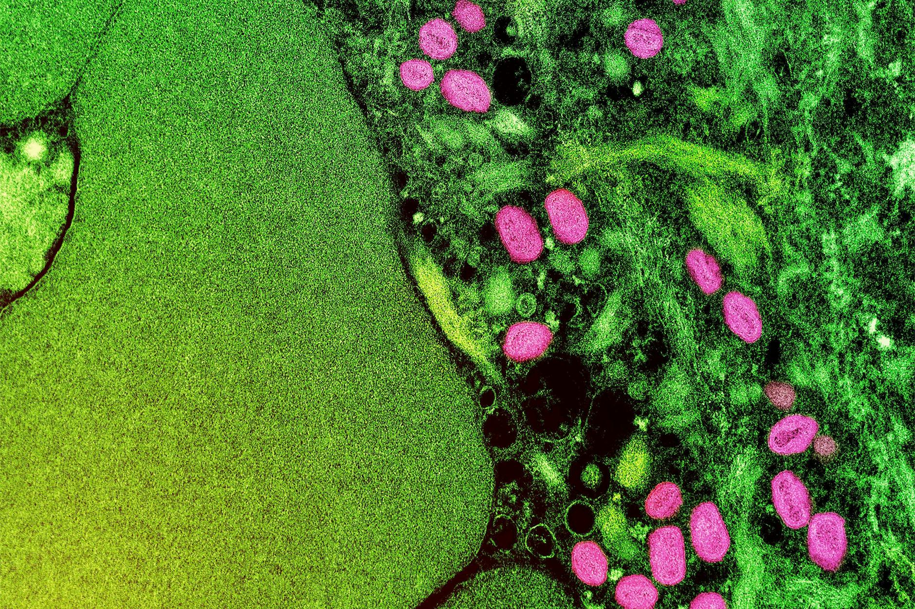 Eine rasterelektronenmikroskopische Aufnahme eines Affenpockenvirus