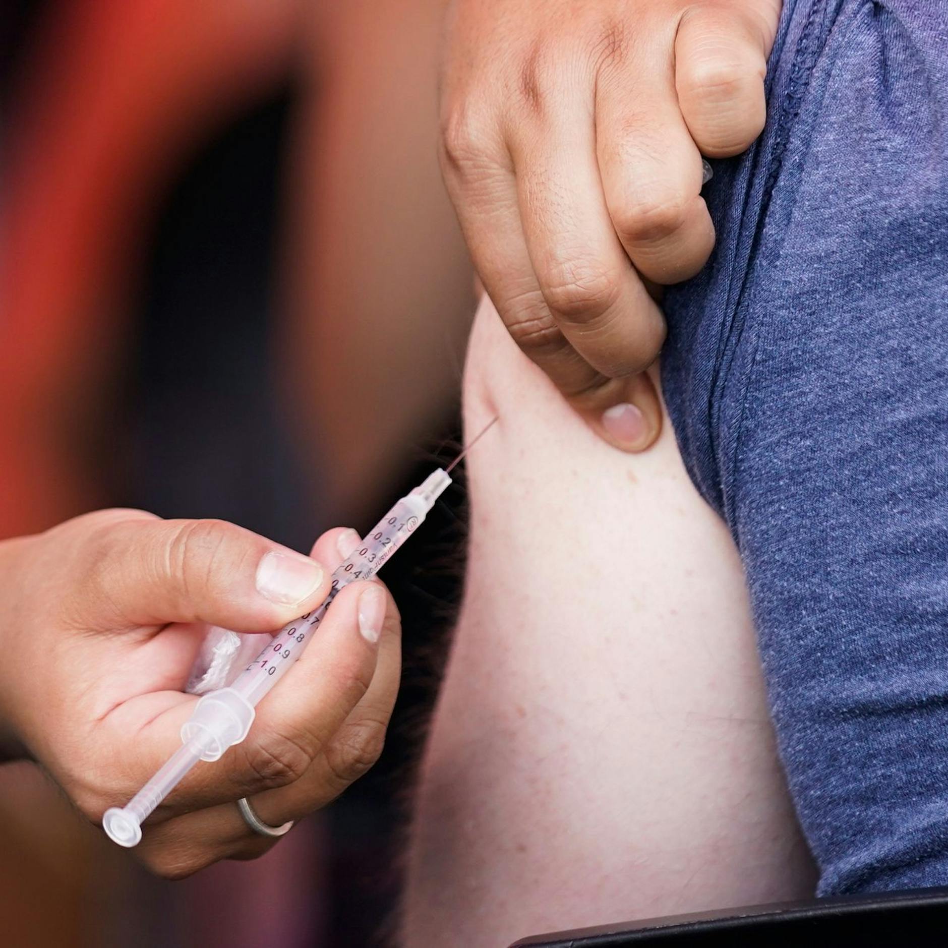 Image - Affenpocken-Impfung: Berliner Verwaltung schließt weitere Verträge ab