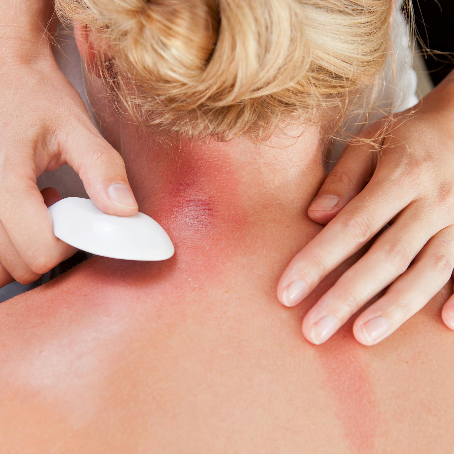 Gua Sha: Der neue Wellnesstrend – was bringt das Rückenschaben aus der traditionellen Chinesischen Medizin?