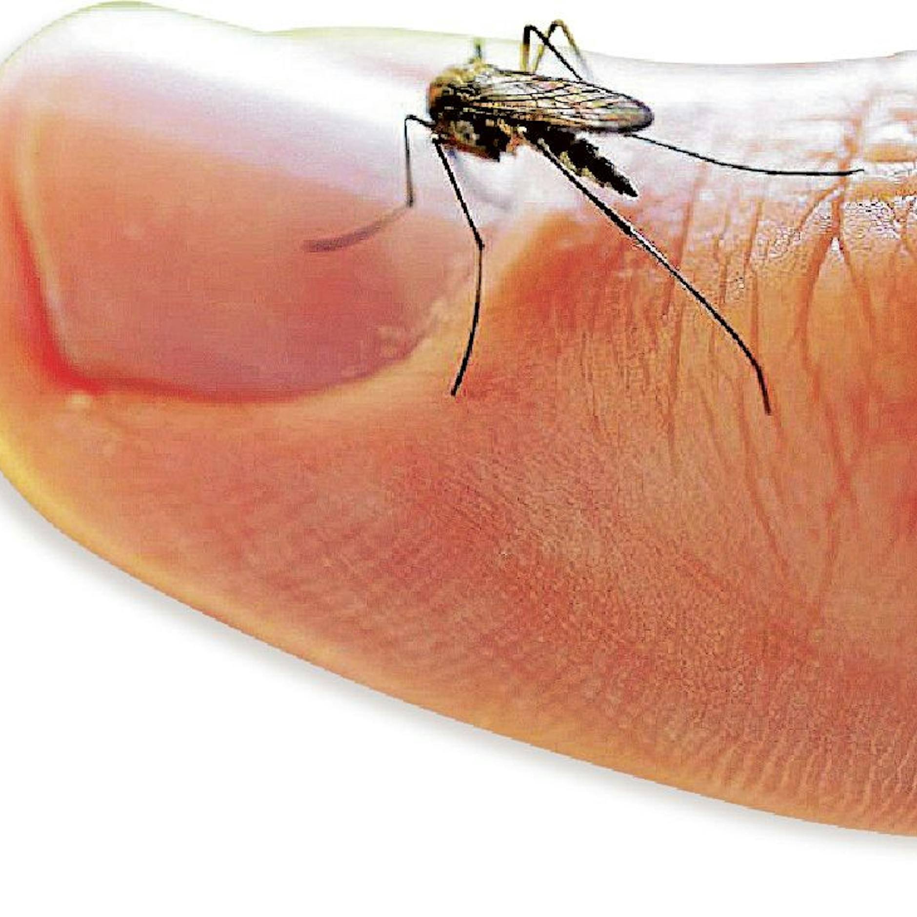 Mücken vertreiben: 6 Tricks, die WIRKLICH funktionieren – ganz ohne Chemie!