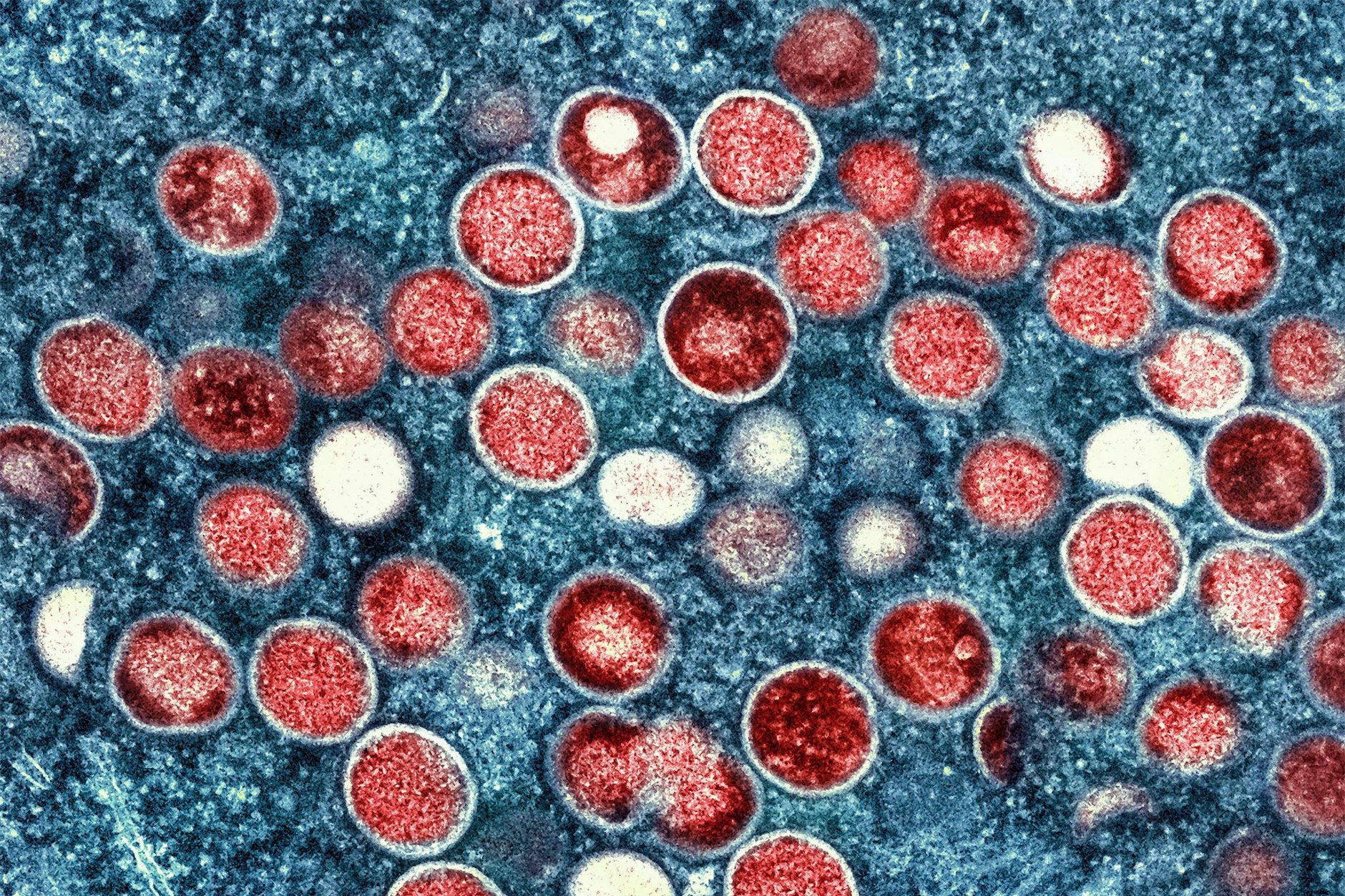 Eine kolorierte transmissionselektronenmikroskopische Aufnahme von Partikeln des Affenpockenvirus.