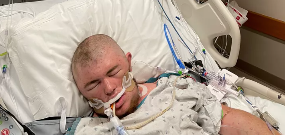 Image - 20.000 Killer-Bienen attackieren Mann (20): Jetzt liegt er im Koma!