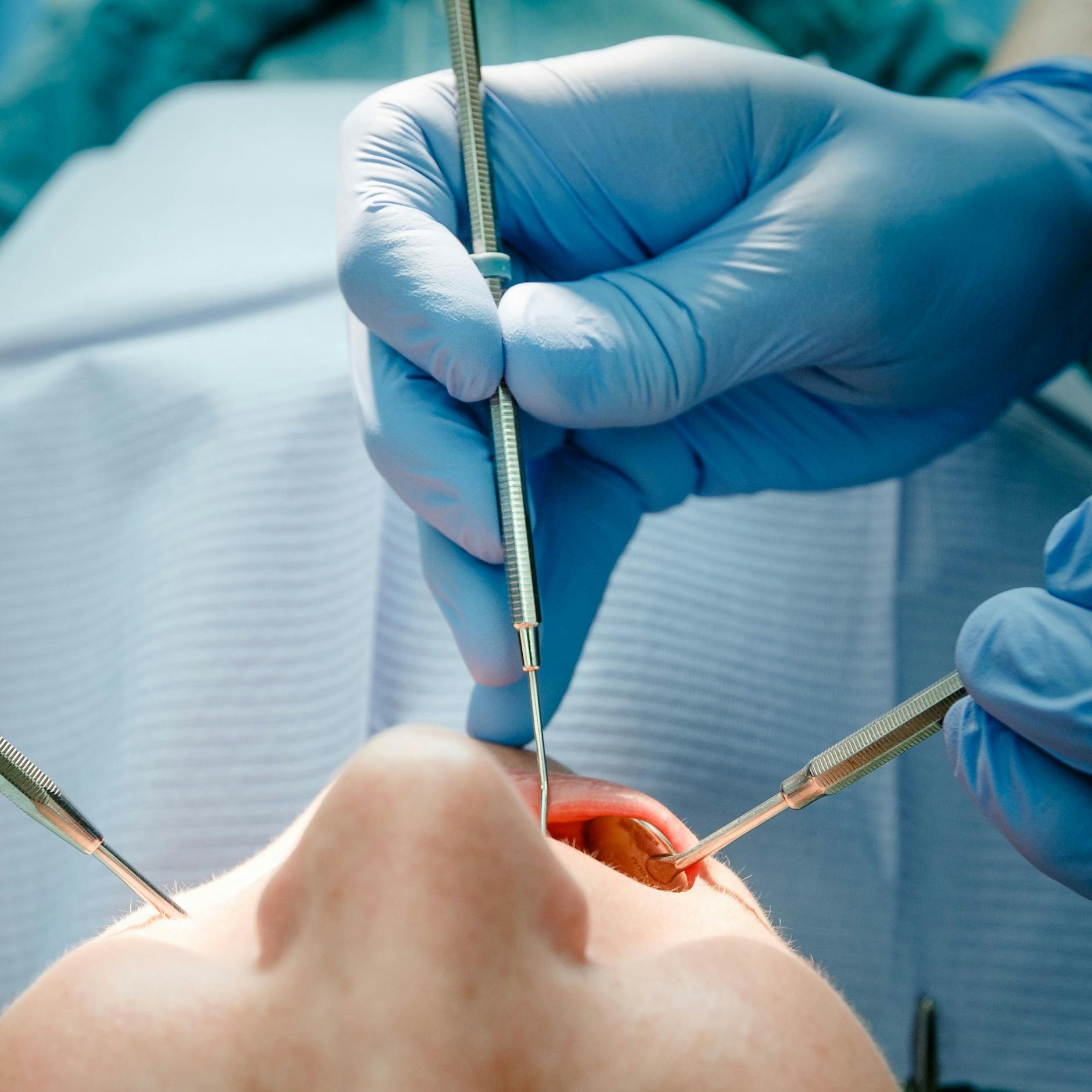 Hunderten Patienten zog der Arzt gesunde Zähne.