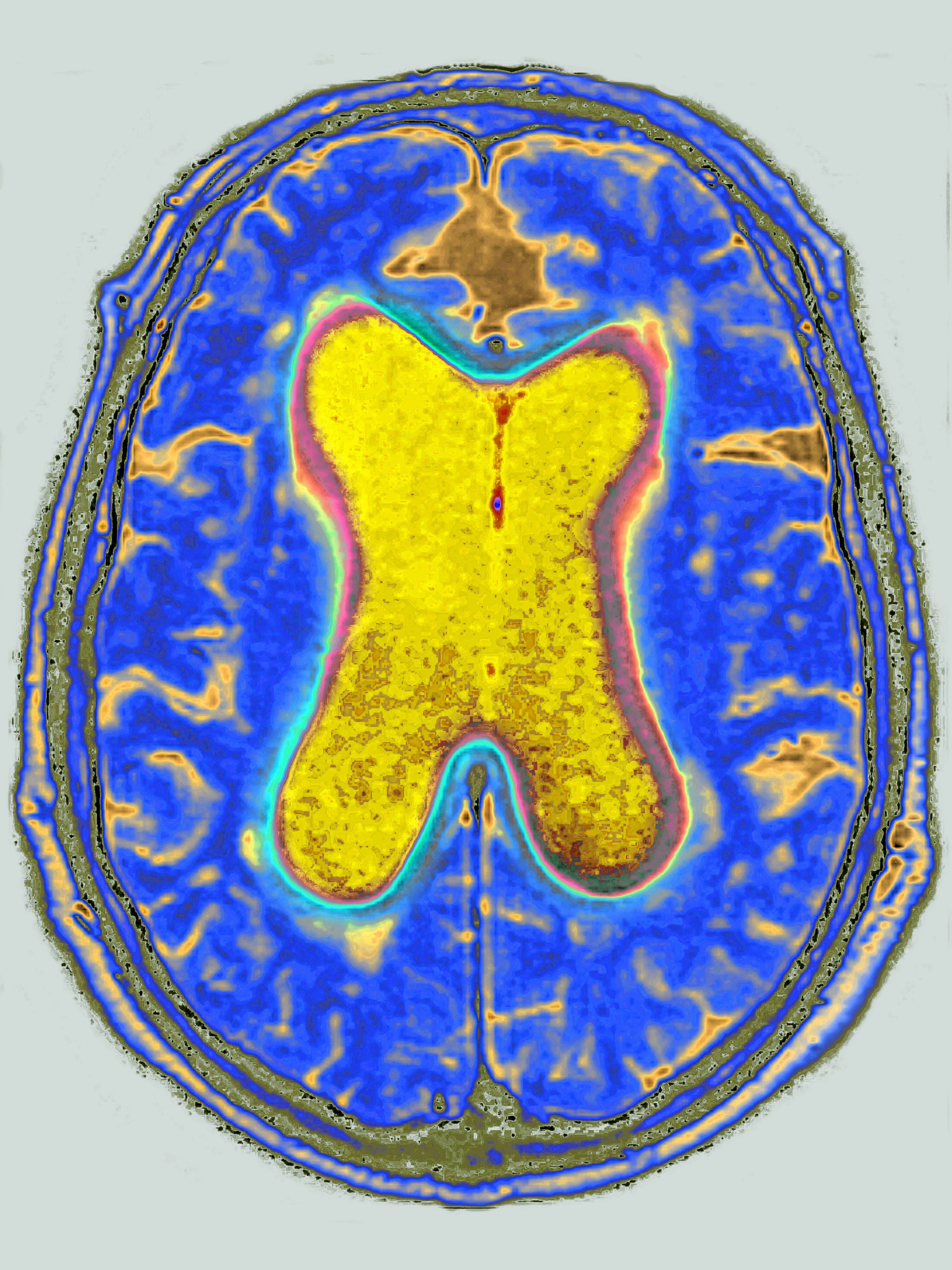 Ein Gehirn-Scan.
